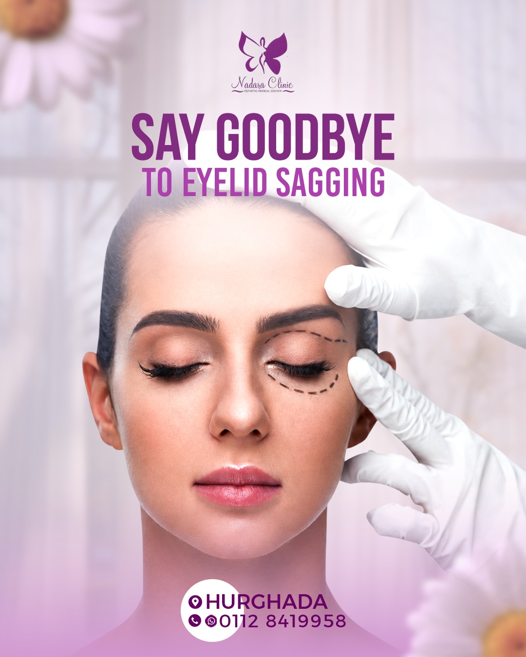 Treatment of sagging eyelids in Hurghada